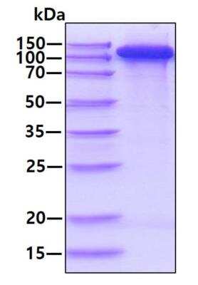 SDS-PAGE: Recombinant Human CD21 His Protein [NBP2-77494]