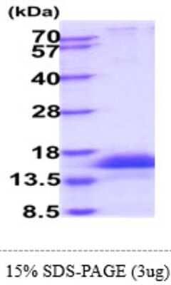 SDS-PAGE: Recombinant Human CD3 zeta His Protein [NBP2-61462]