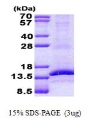 SDS-PAGE: Recombinant Human CD3 gamma His Protein [NBP2-22753]