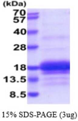 SDS-PAGE: Recombinant Human CD3 gamma His Protein [NBP2-59572]