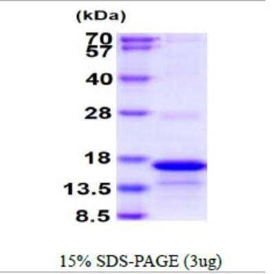 SDS-PAGE: Recombinant Human CD3 zeta His Protein [NBP2-22747]