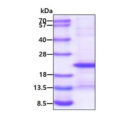SDS-PAGE: Recombinant Human CD300e/LMIR6 His Protein [NBP2-51872]