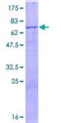 SDS-PAGE: Recombinant Human CD36 GST (N-Term) Protein [H00000948-P02]