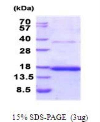 SDS-PAGE: Recombinant Human CD37 His Protein [NBP2-51893]