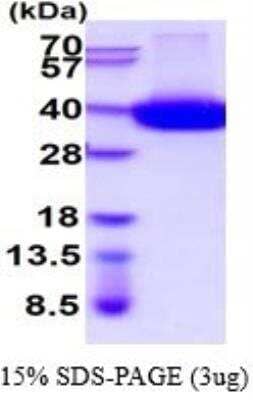 SDS-PAGE: Recombinant Human CD38 His Protein [NBP2-52339]