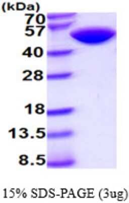 SDS-PAGE: Recombinant Human CD4 His Protein [NBP2-50553]