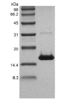 SDS-PAGE: Recombinant Human CD40 Ligand/TNFSF5 Protein [NBP2-35244]