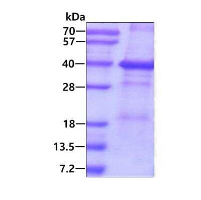 SDS-PAGE: Recombinant Human CD46 His Protein [NBP2-22754]