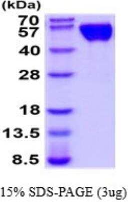 SDS-PAGE: Recombinant Human CD47 hIgG-His Protein [NBP2-52320]