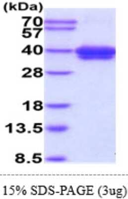 SDS-PAGE: Recombinant Human CD52 hIgG-His Protein [NBP2-61993]