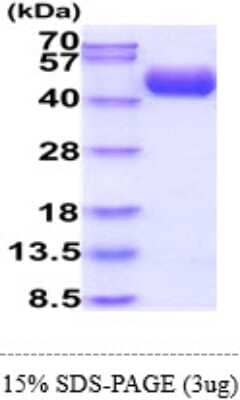 SDS-PAGE: Recombinant Human CD55/DAF Isoform 1 His Protein [NBP2-61982]