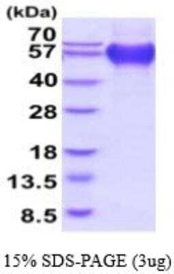 SDS-PAGE: Recombinant Human CD68/SR-D1 His Protein [NBP2-53081]