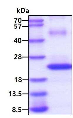 SDS-PAGE: Recombinant Human CD74 His Protein [NBP2-22758]