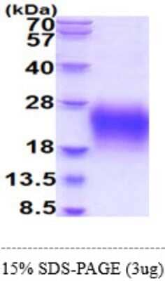 SDS-PAGE: Recombinant Human CD79A His Protein [NBP2-60209]