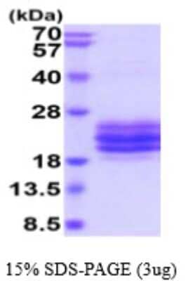 SDS-PAGE: Recombinant Human CD79B His Protein [NBP2-59563]