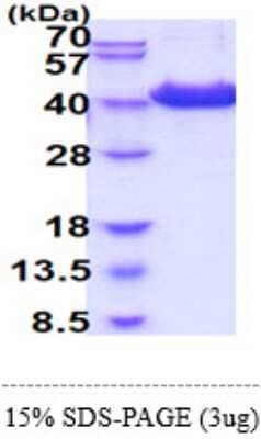 SDS-PAGE: Recombinant Human CD81 hIgG-His Protein [NBP2-60215]