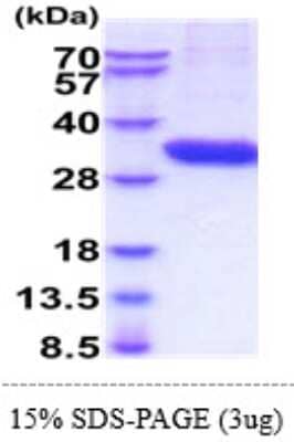 SDS-PAGE: Recombinant Human Tryptase alpha/beta 1 His Protein [NBP2-61189]
