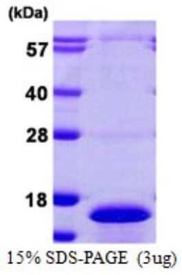 SDS-PAGE: Recombinant Human CDC26 His Protein [NBP1-72341]