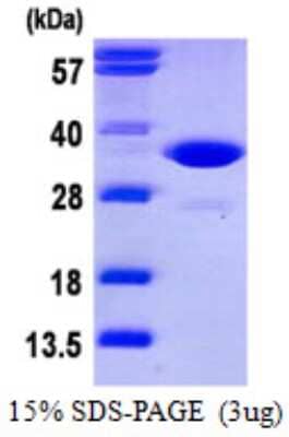 SDS-PAGE: Recombinant Human CDK2 His Protein [NBP1-72424]