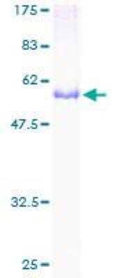 SDS-PAGE: Recombinant Human CDK20 GST (N-Term) Protein [H00023552-P01]