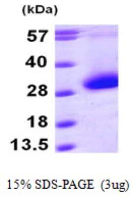 SDS-PAGE: Recombinant Human CDKN3 His Protein [NBP1-50909]