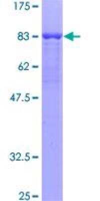 SDS-PAGE: Recombinant Human CDR2 GST (N-Term) Protein [H00001039-P01]