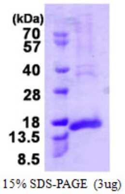 SDS-PAGE: Recombinant Human CENPH His Protein [NBP1-72449]