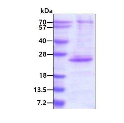 SDS-PAGE: Recombinant Human CENPM His Protein [NBP3-15117]