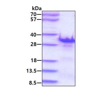 SDS-PAGE: Recombinant Human CHMP1B His Protein [NBP1-98957]