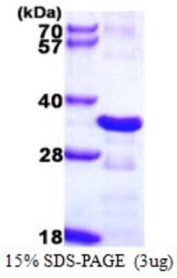 SDS-PAGE: Recombinant Human CHMP2B His Protein [NBP1-72361]