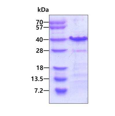 SDS-PAGE: Recombinant Human CHMP4A His Protein [NBP1-78875]