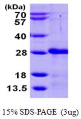 SDS-PAGE: Recombinant Human CIB2 His Protein [NBP1-50988]