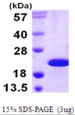 SDS-PAGE: Recombinant Human CIRBP His Protein [NBP1-51095]