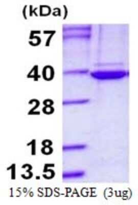 SDS-PAGE: Recombinant Human CKAP1 His Protein [NBP1-98948]