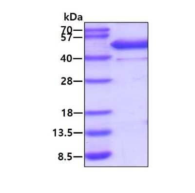 SDS-PAGE: Recombinant Human CKMT2 His Protein [NBP1-98930]