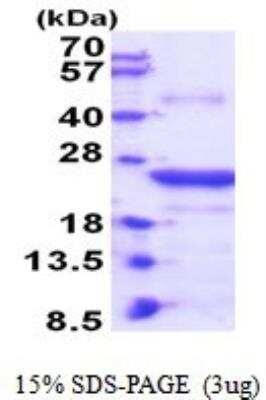 SDS-PAGE: Recombinant Human CLEC4E His Protein [NBP2-52028]