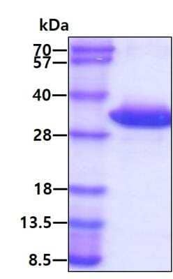 SDS-PAGE: Recombinant Human CLIC1 His Protein [NBP1-44454]