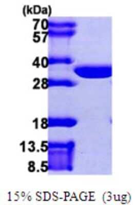 SDS-PAGE: Recombinant Human CLIC2 His Protein [NBP1-51087]