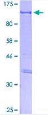 SDS-PAGE: Recombinant Human CLOCK GST (N-Term) Protein [H00009575-P01]