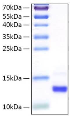 SDS-PAGE: Recombinant Human CLPS His (C-Term) Protein [NBP3-18200]