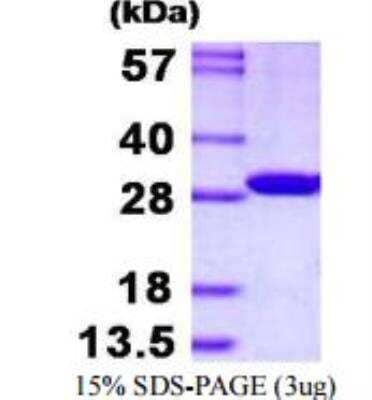 SDS-PAGE: Recombinant Human CMBL His Protein [NBP1-98884]