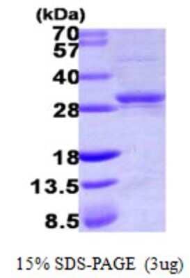 SDS-PAGE: Recombinant Human CMP kinase His Protein [NBP1-51052]