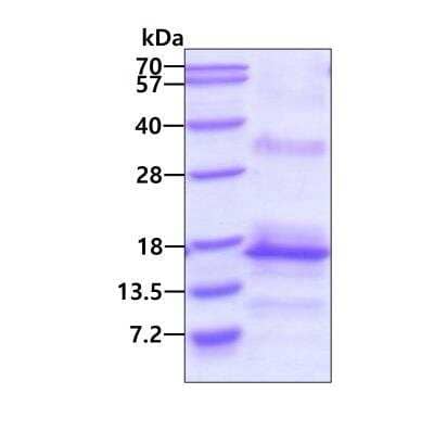 SDS-PAGE: Recombinant Human CNPY1 His Protein [NBP2-51580]