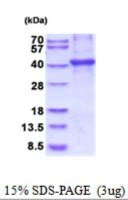 SDS-PAGE: Recombinant Human CNTFR His Protein [NBP2-52015]