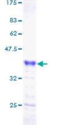 SDS-PAGE: Recombinant Human COM1/p8 GST (N-Term) Protein [H00026471-P01]