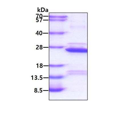 SDS-PAGE: Recombinant Human COMMD1 His Protein [NBP1-50846]