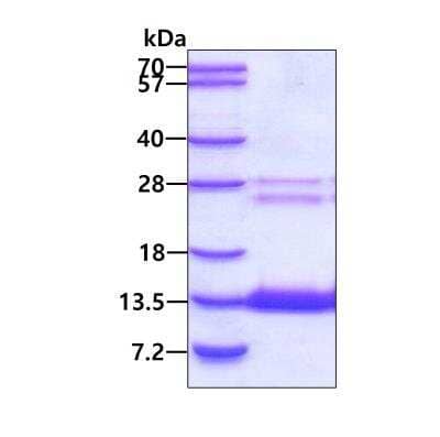 SDS-PAGE: Recombinant Human COMMD6 His Protein [NBP2-51781]