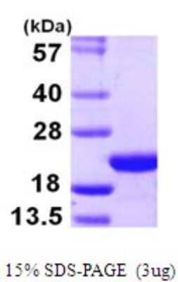 SDS-PAGE: Recombinant Human COPZ1 His Protein [NBP1-72296]