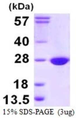 SDS-PAGE: Recombinant Human COX4NB His Protein [NBP1-72435]