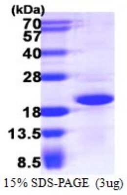 SDS-PAGE: Recombinant Human CRCP His Protein [NBP1-72438]